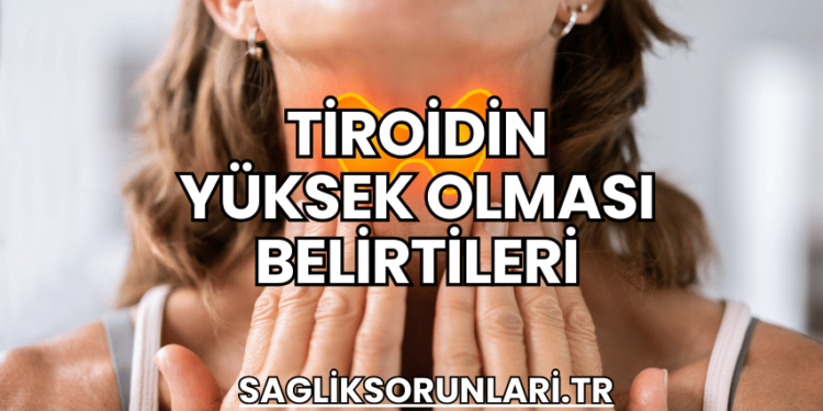 Tiroidin Yüksek Olması Belirtileri