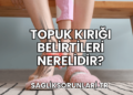 Topuk Kırığı Belirtileri Nerelidir?