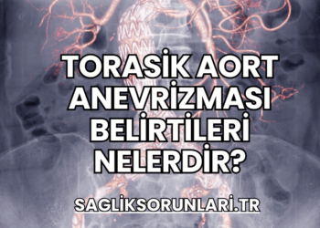 Torasik Aort Anevrizması Belirtileri Nelerdir?