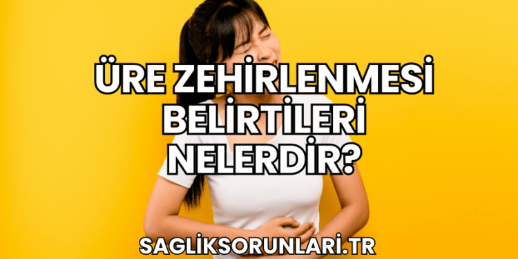 Üre Zehirlenmesi Belirtileri Nelerdir?
