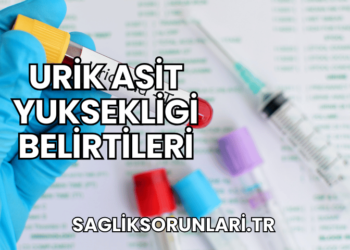 Urik Asit Yuksekligi Belirtileri