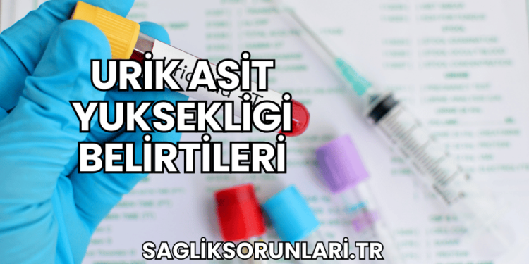 Urik Asit Yuksekligi Belirtileri