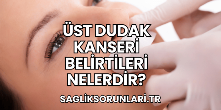 Üst Dudak Kanseri Belirtileri Nelerdir?