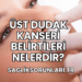 Üst Dudak Kanseri Belirtileri Nelerdir?