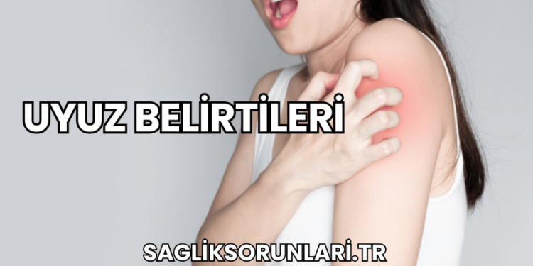 Uyuz Belirtileri