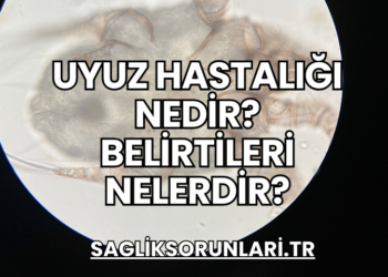Uyuz Hastalığı Nedir? Belirtileri Nelerdir?