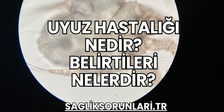 Uyuz Hastalığı Nedir? Belirtileri Nelerdir?