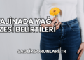 Vajinada Yağ Bezesi Belirtileri