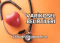 Varikosel Belirtileri