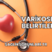 Varikosel Belirtileri