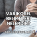 Varikosel Belirtileri Nelerdir?