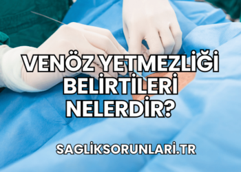 Venöz Yetmezliği Belirtileri Nelerdir?