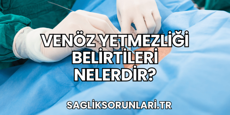 Venöz Yetmezliği Belirtileri Nelerdir?