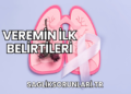 Veremin İlk Belirtileri