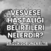 Vesvese Hastalığı Belirtileri Nelerdir?