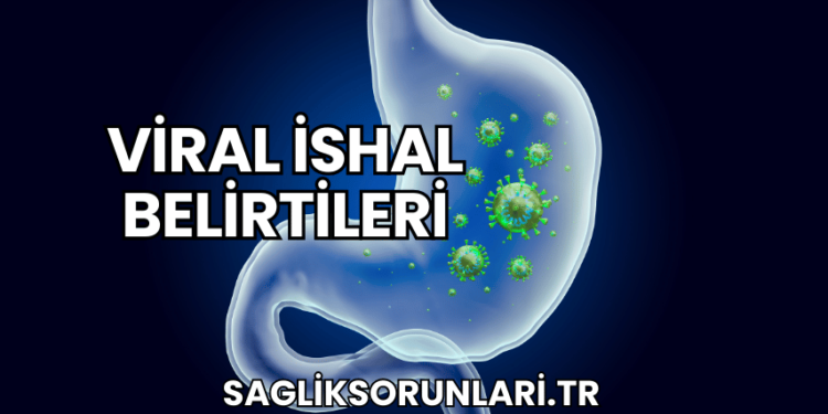 Viral İshal Belirtileri