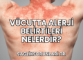 Vücutta Alerji Belirtileri Nelerdir?