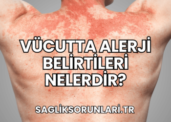 Vücutta Alerji Belirtileri Nelerdir?