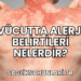 Vücutta Alerji Belirtileri Nelerdir?