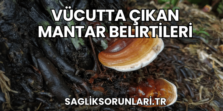 Vücutta Çıkan Mantar Belirtileri