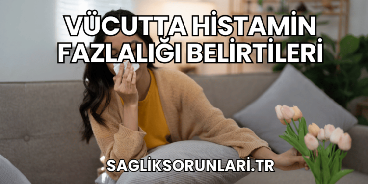 Vücutta Histamin Fazlalığı Belirtileri