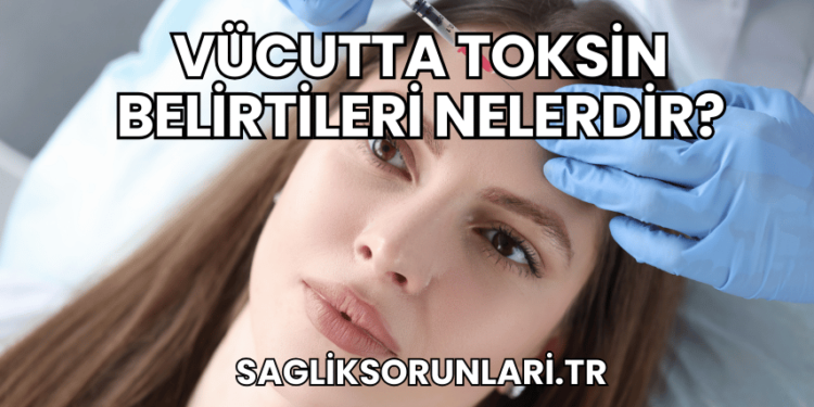 Vücutta Toksin Belirtileri Nelerdir?