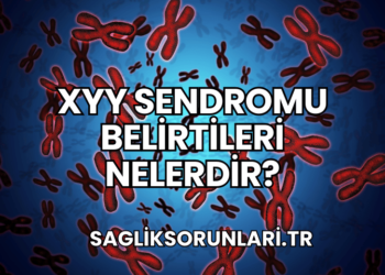 XYY Sendromu Belirtileri Nelerdir?