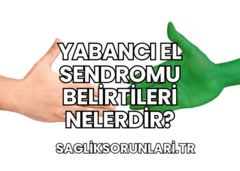 Yabancı El Sendromu Belirtileri Nelerdir?