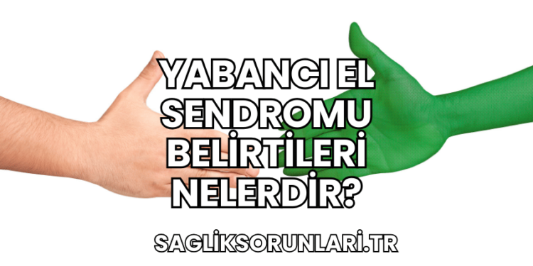 Yabancı El Sendromu Belirtileri Nelerdir?