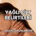 Yağlı Cilt Belirtileri