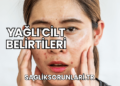 Yağlı Cilt Belirtileri