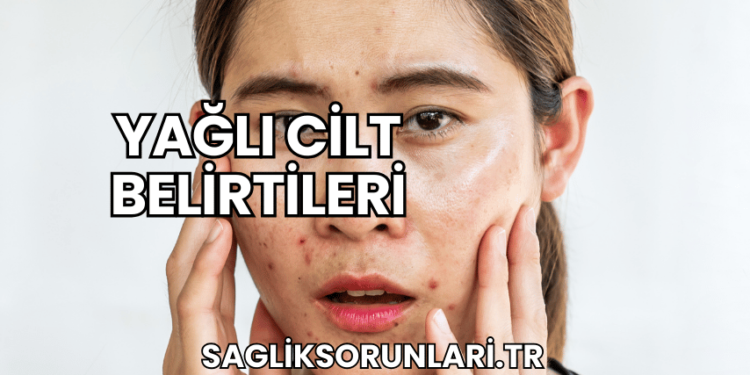 Yağlı Cilt Belirtileri