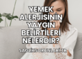 Yemek Alerjisinin Yaygın Belirtileri Nelerdir?