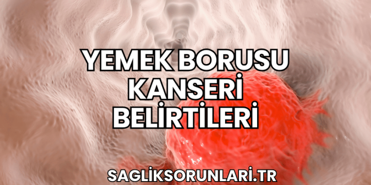 Yemek Borusu Kanseri Belirtileri