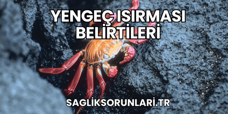 Yengeç Isırması Belirtileri