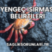 Yengeç Isırması Belirtileri