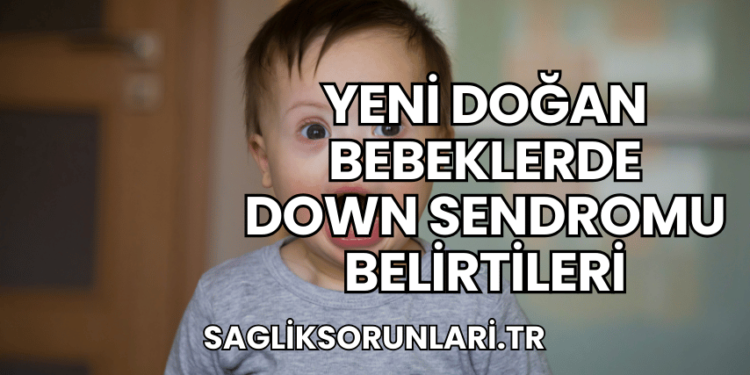 Yeni Doğan Bebeklerde Down Sendromu Belirtileri