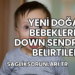 Yeni Doğan Bebeklerde Down Sendromu Belirtileri