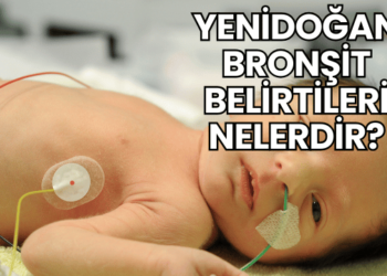Yenidoğan Bronşit Belirtileri Nelerdir?