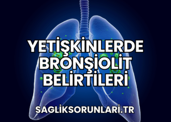 Yetişkinlerde Bronşiolit Belirtileri