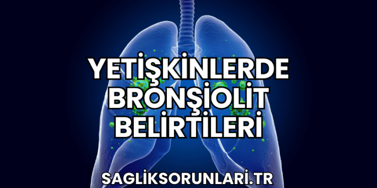 Yetişkinlerde Bronşiolit Belirtileri