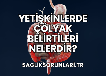 Yetişkinlerde Çölyak Belirtileri Nelerdir?
