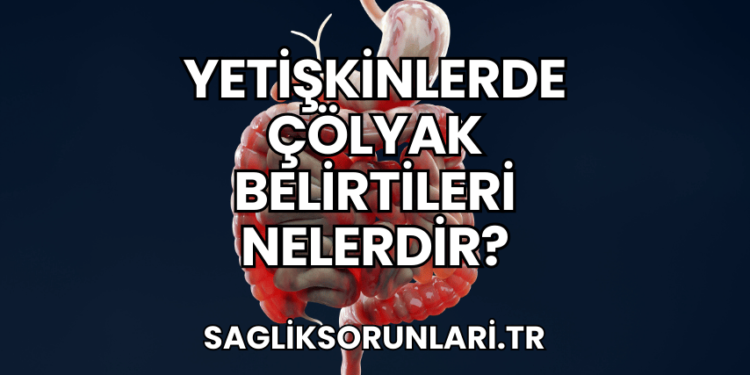 Yetişkinlerde Çölyak Belirtileri Nelerdir?