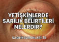 Yetişkinlerde Sarılık Belirtileri Nelerdir?