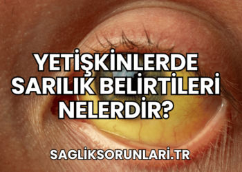 Yetişkinlerde Sarılık Belirtileri Nelerdir?