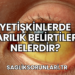 Yetişkinlerde Sarılık Belirtileri Nelerdir?