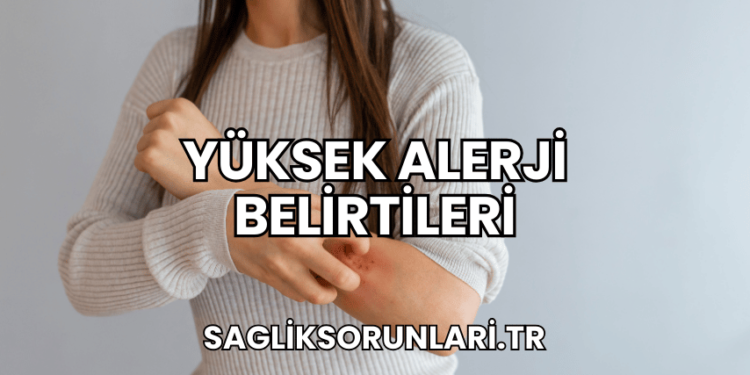 Yüksek Alerji Belirtileri