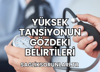 Yüksek Tansiyonun Gözdeki Belirtileri