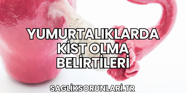 Yumurtalıklarda Kist Olma Belirtileri