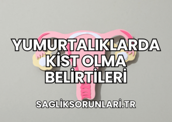 Yumurtalıklarda Kist Olma Belirtileri